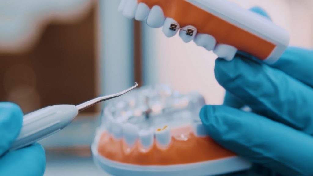 La brosse à dents rechargeable : une solution pour un sourire rayonnant